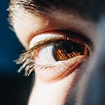 Eye Image