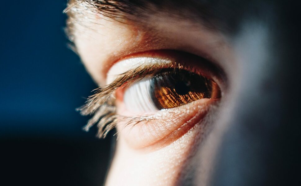Eye Image